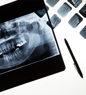 Digital dental x-rays