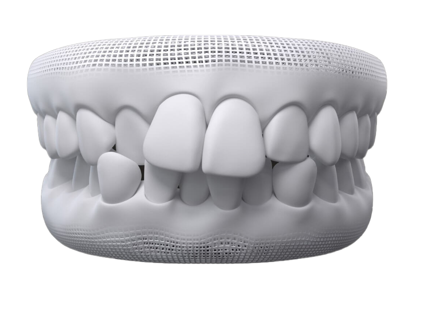 image of crooked teeth