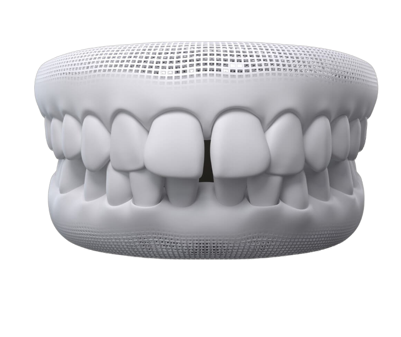 image of gap teeth