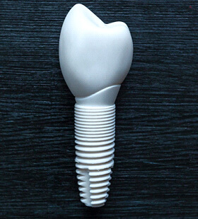 A ceramic dental implant