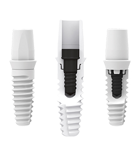 Animation of dental implant process