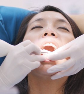 Woman undergoing scaling and root planing   