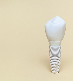 A single dental implant