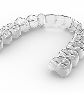 Invisalign aligner  