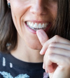 Patient inserting Invisalign aligner into mouth  