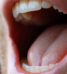 Up-close view of a person’s mouth 