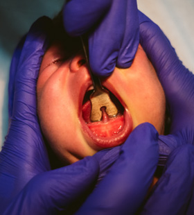 Baby with a tongue-tie