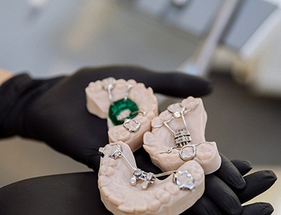 Dentist holding different types of palate expanders 