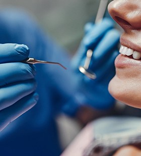 Woman during dental checkup in Delafield