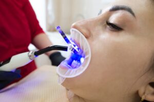 Female patient undergoing dental bonding