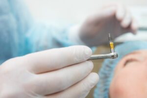 Dentist holding a dental implant